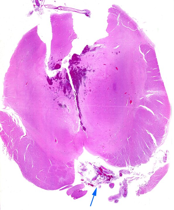 13B1 PAN (Case 13) WM copy