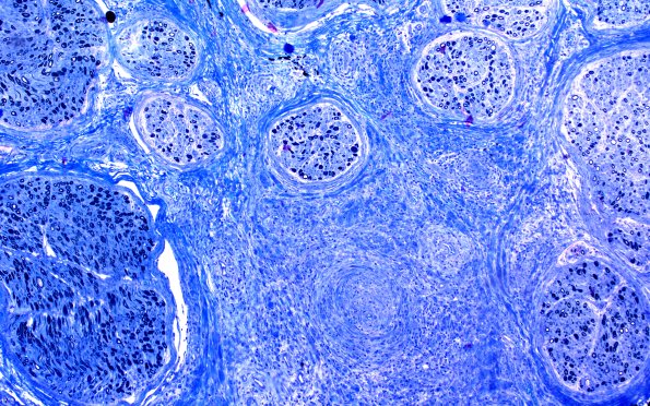 1C2 PAN (Case 1) Plastic 10X 2