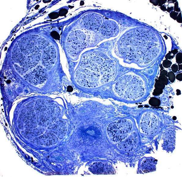 1C4 PAN (Case 1) Plastic 4X a