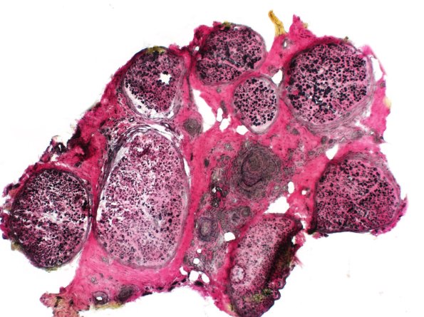 7B1 PAN (Case 7) VVG 4X