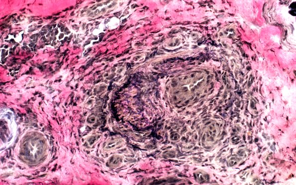 7B3 PAN (Case 7) VVG 40X 2