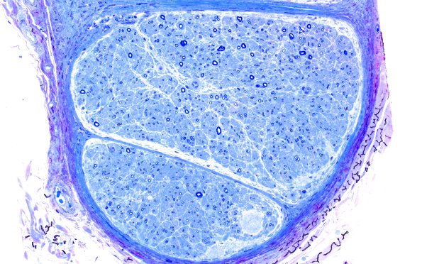 1D2 Anti-MAG NP (Case 1) Plastic 20X 1