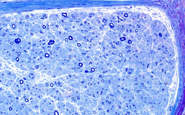 1D3 Anti-MAG NP (Case 1) Plastic 40X 2