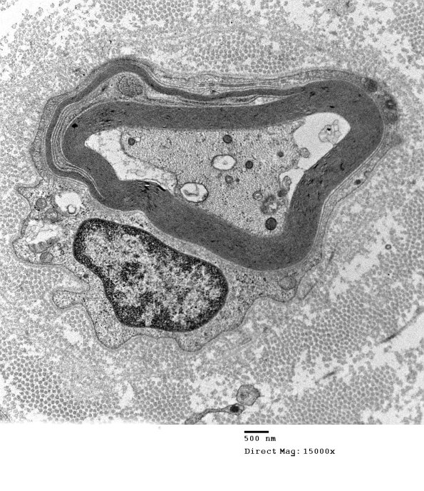 1E10A Anti-MAG (Case 1) _025 - Copy