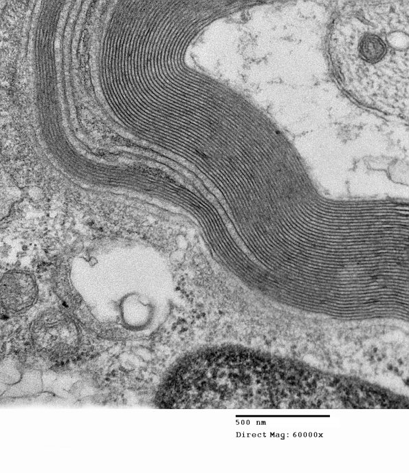 1E10B Anti-MAG (Case 1)_026 - Copy