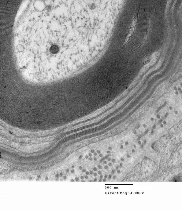 1E13B Anti-MAG (Case 1)_005 - Copy