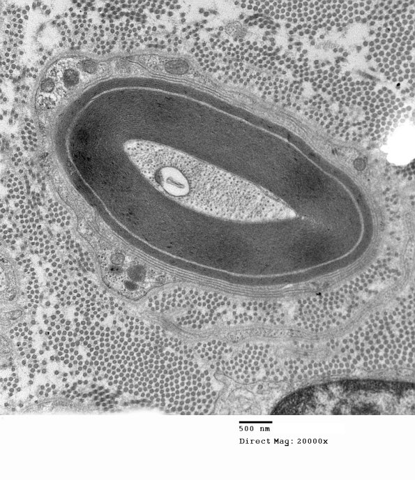 1E14A Anti-MAG (Case 1)_006 - Copy