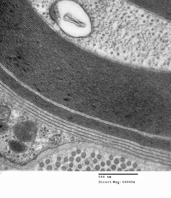 1E14B Anti-MAG (Case 1) 008 - Copy