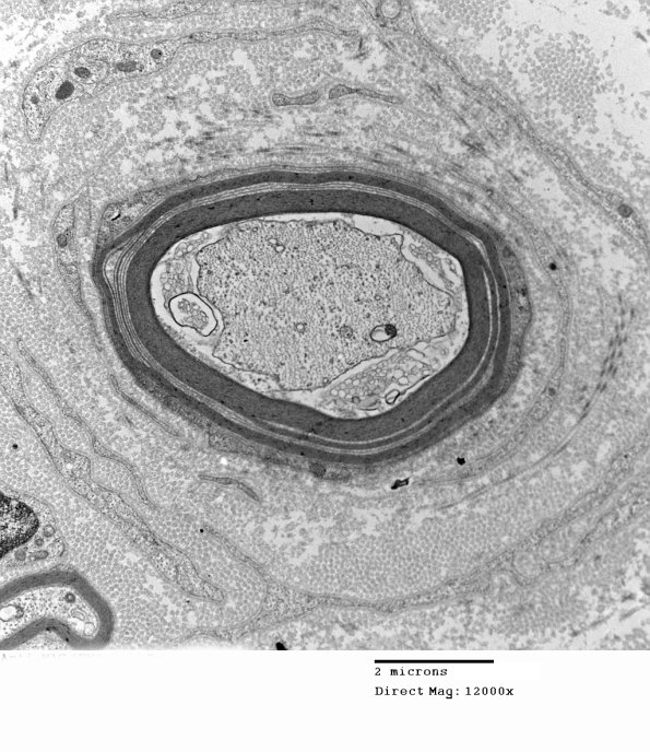 1E15A Anti-MAG (Case 1) 017 - Copy