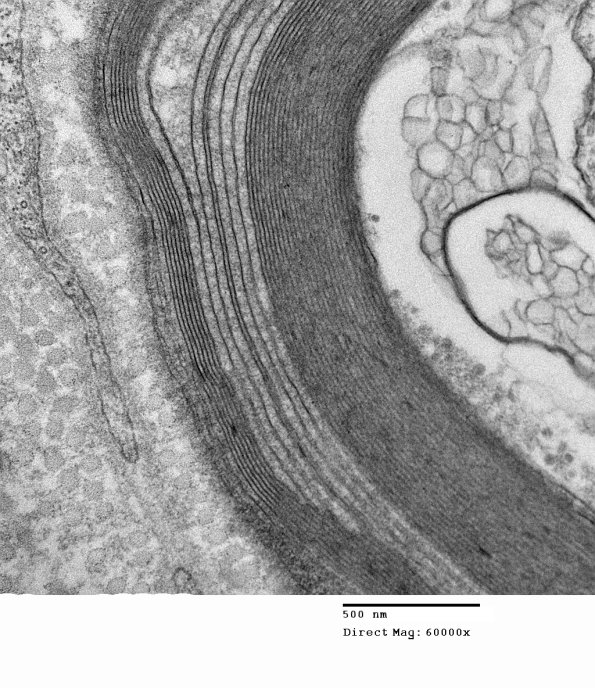 1E15C Anti-MAG (Case 1)_014 - Copy