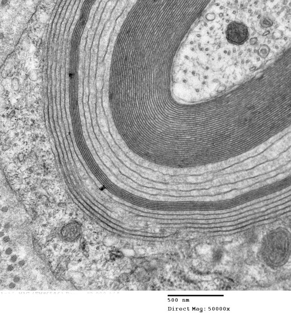 1E1B Anti-MAG (Case 1) #2_009 - Copy A