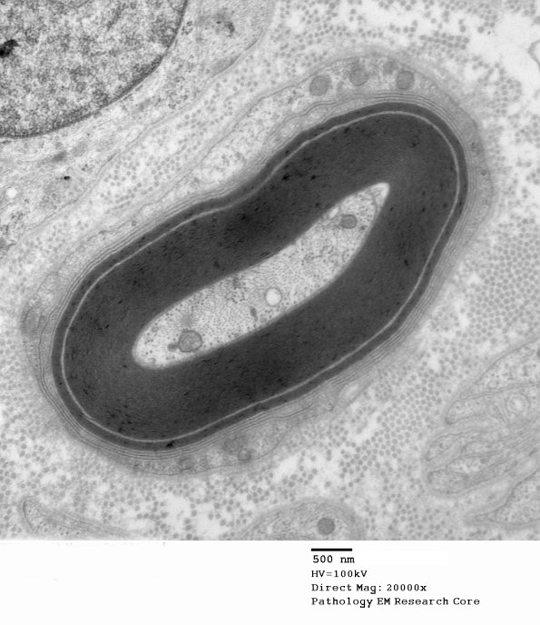 1E6A Anti-MAG (Case 1) 012 - Copy