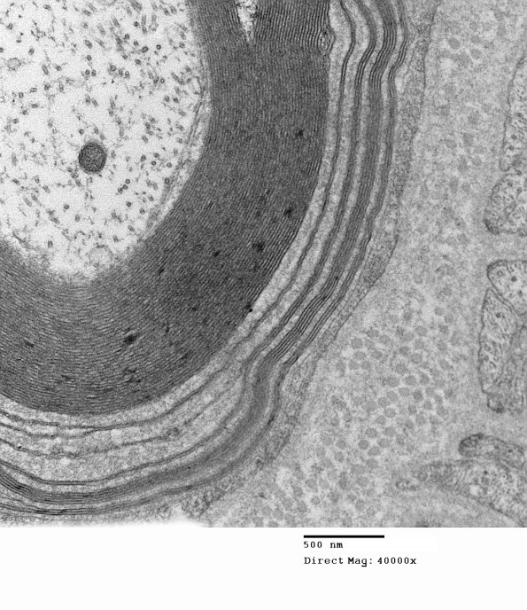 1E7B Anti-MAG (Case 1) 023 - Copy