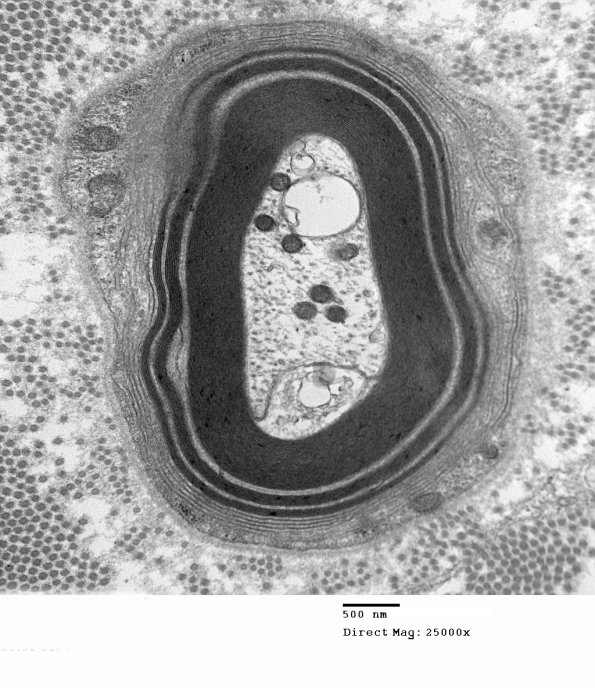 1E8A Anti-MAG NP (Case 1) EM 004 - Copy