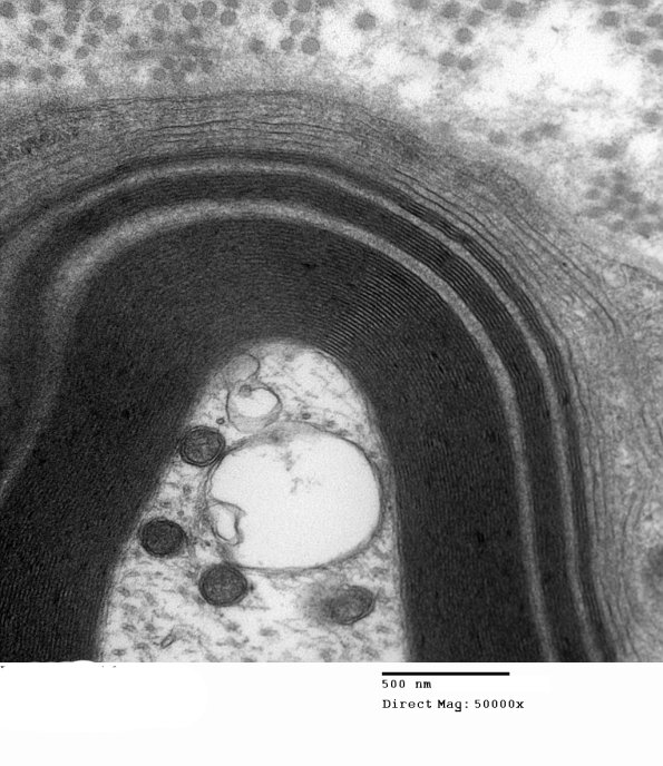 1E8C Anti-MAG NP (Case 1) EM 007 - Copy