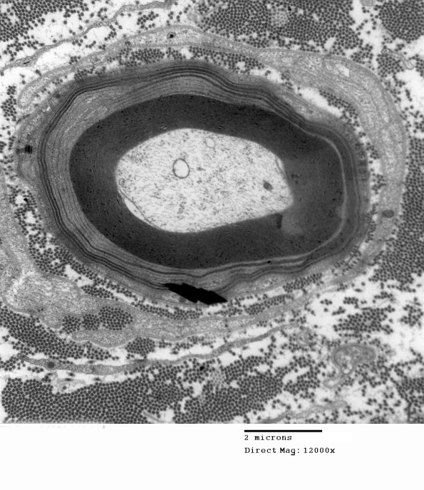 1E9A EM (Case 1)_013 - Copy