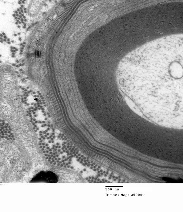 1E9B EM (Case 1)_010 - Copy