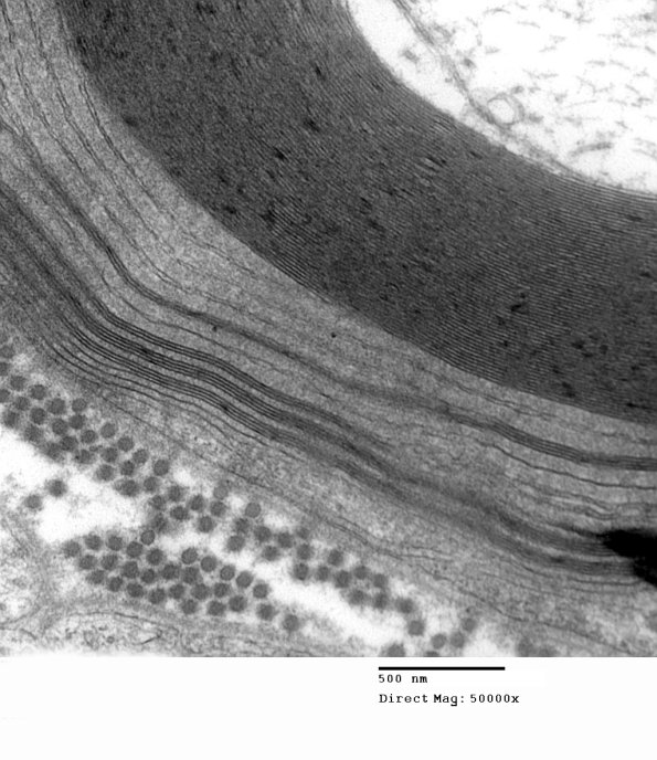 1E9C EM (Case 1) _012 - Copy