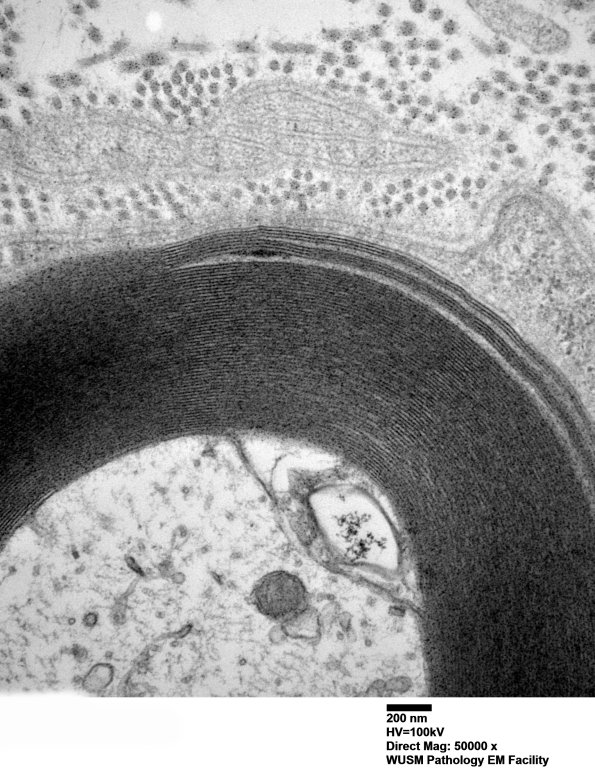 2B1B (Case 2) 034 - Copy