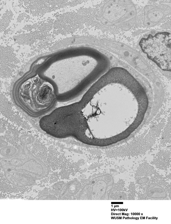 2B2A (Case 2) 006 - Copy