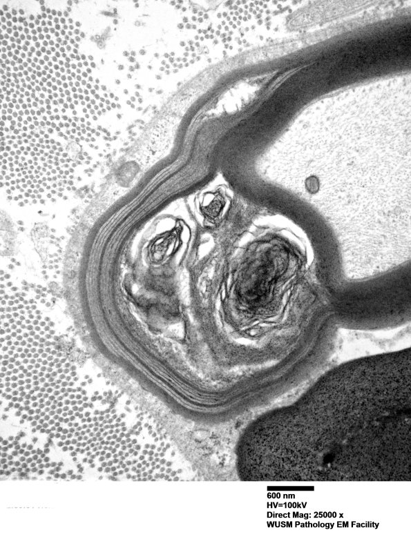 2B2B (Case 2) 007 - Copy