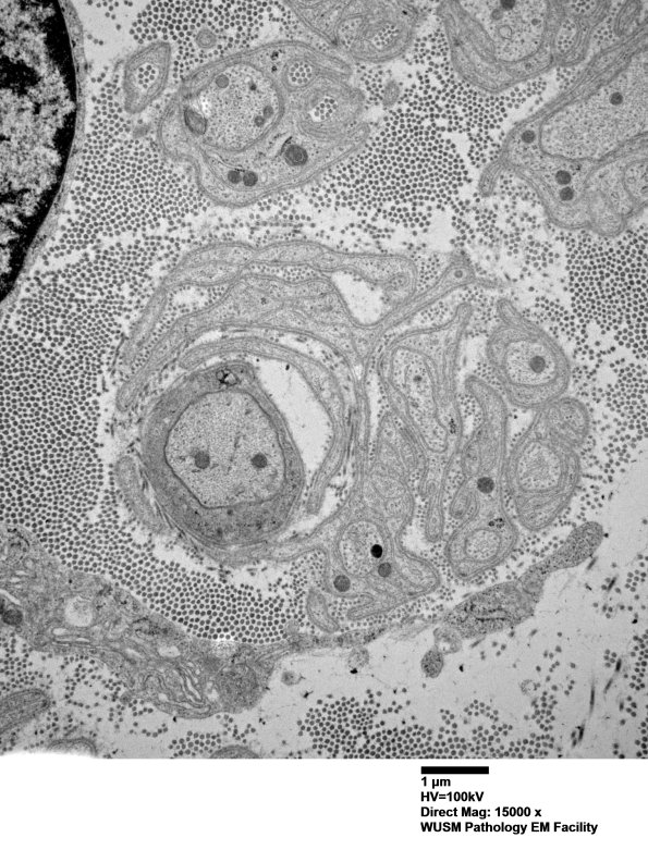 2C1 (Case 2) 013 - Copy