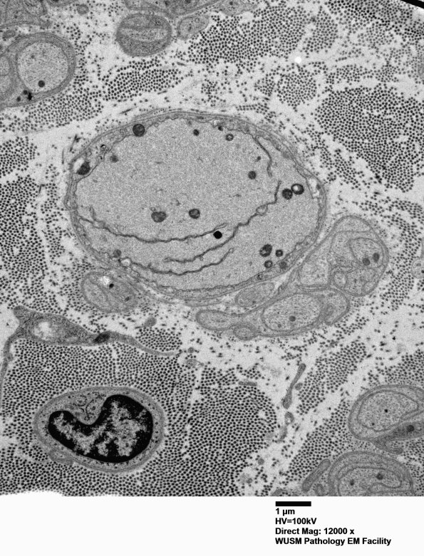 2C2 (Case 2) 022 - Copy