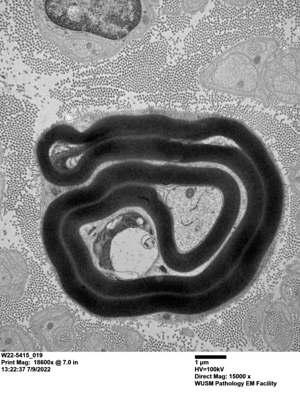 2C4 (Case 2) 019 - Copy