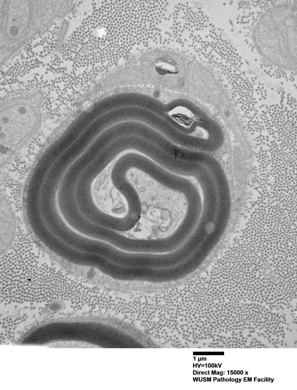 2C5 (Case 2) 029 - Copy