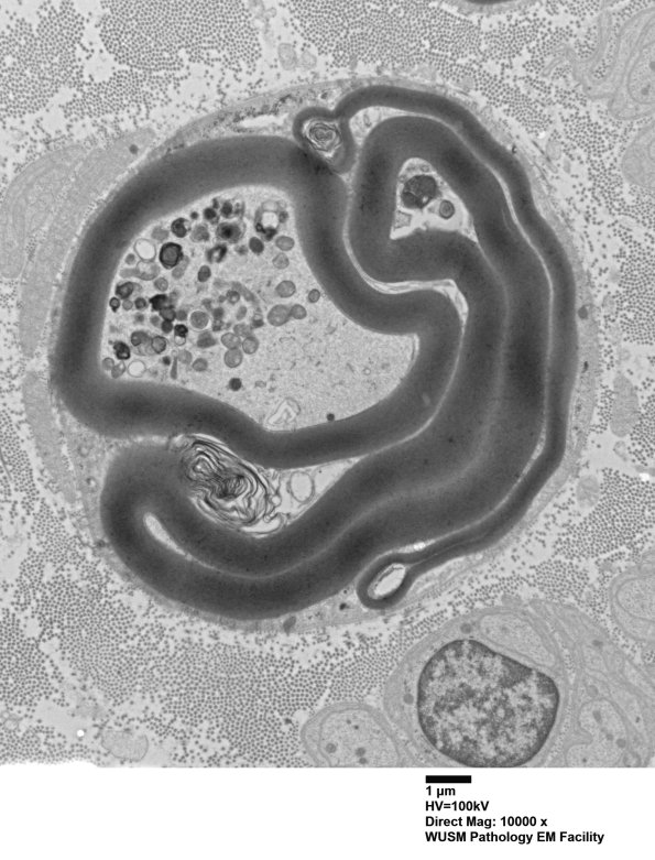 2C6 (Case 2) 30 - Copy