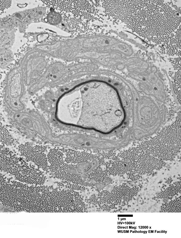 2C7 (Case 2) 031 - Copy