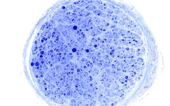 4C1 (Case 4) Plastic 20X 4