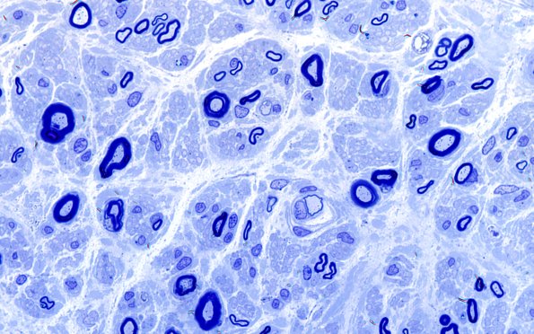 4C3 (Case 4) Plastic 100X 9