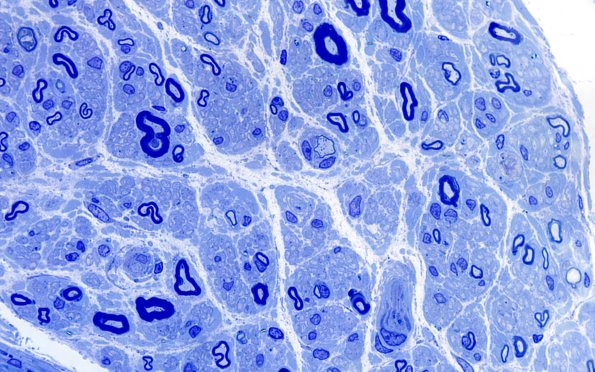 4C4 (Case 4) Plastic 100X 5