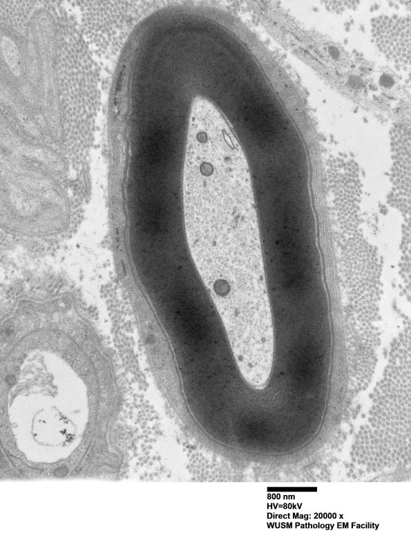 4D3 (Case 4) 031 - Copy