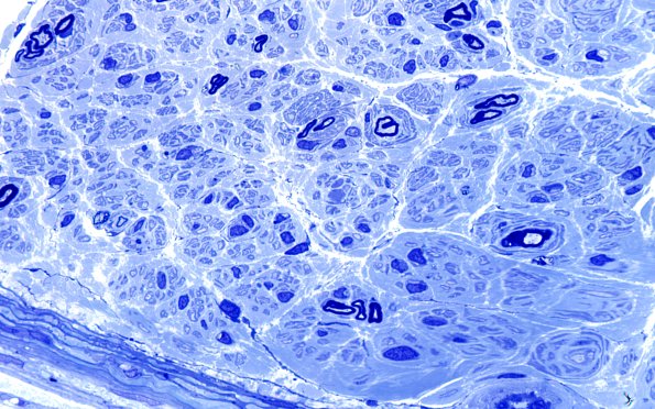 7B3 Anti-MAG (Case 7) Plastic 100X 5