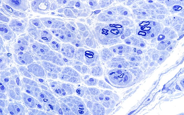 7B5 Anti-MAG (Case 7) Plastic 100X 10