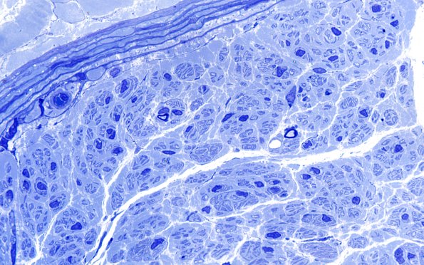 7B6 Anti-MAG (Case 7) Plastic 100X 8