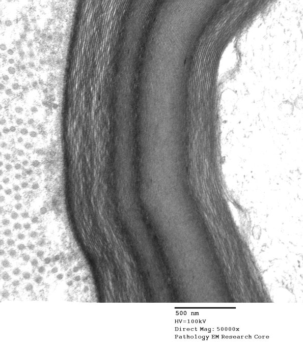 8A3 WSM Mimic (Case 8) Normal nerve EM004 - Copy