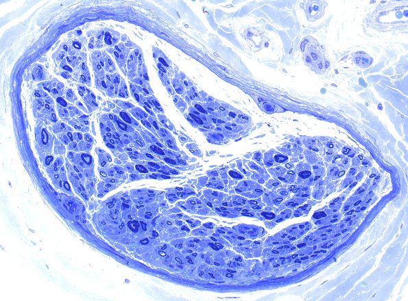 9B (Case 9) Plastic 40X 1