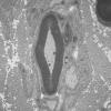 9C1A (Case 9) Nerve_007 - Copy