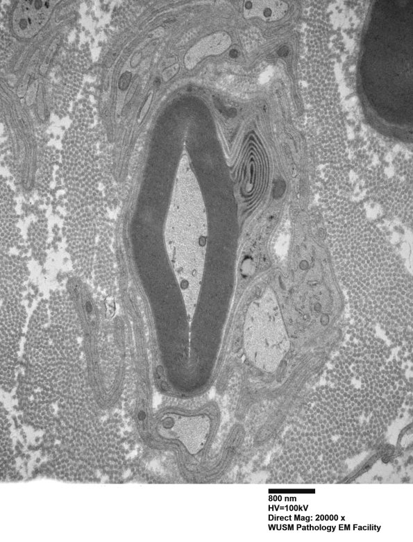 9C1A (Case 9) Nerve_007 - Copy