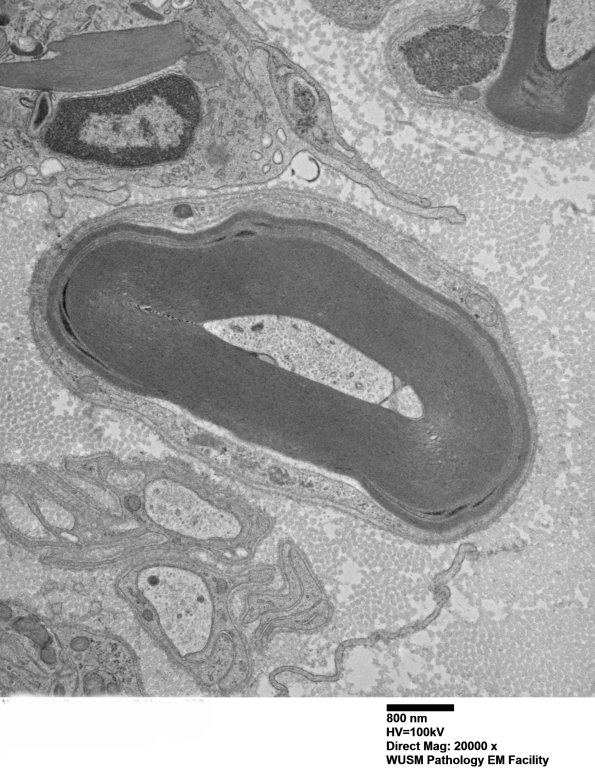 9C2B (Case 9) Nerve_026 - Copy