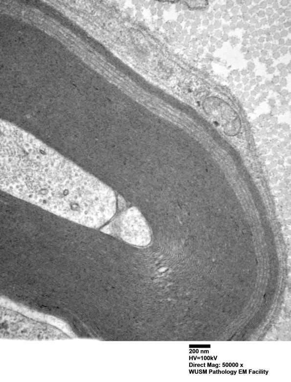 9C2C (Case 9) Nerve_027 - Copy