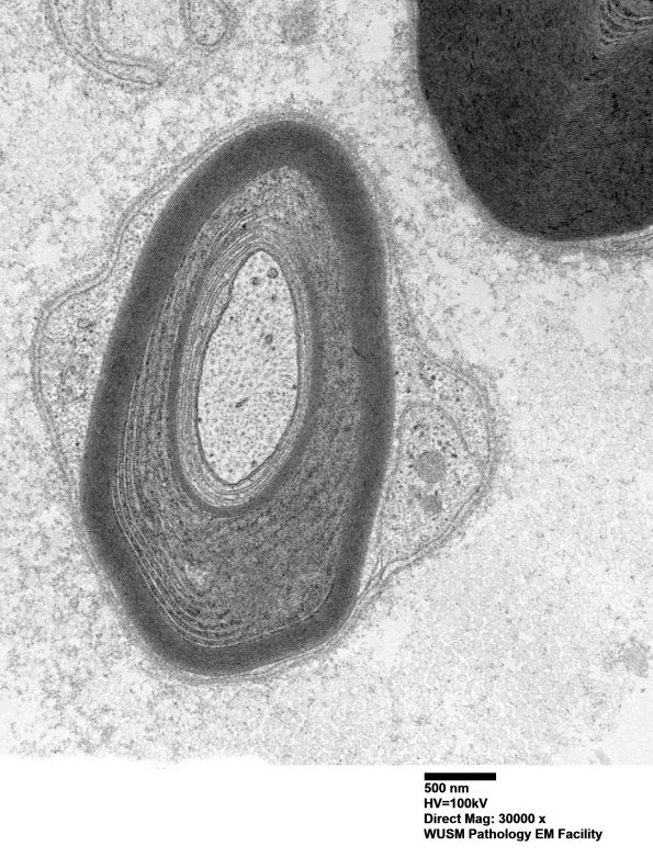 1B2B (Case 1) Sural_036 - Copy