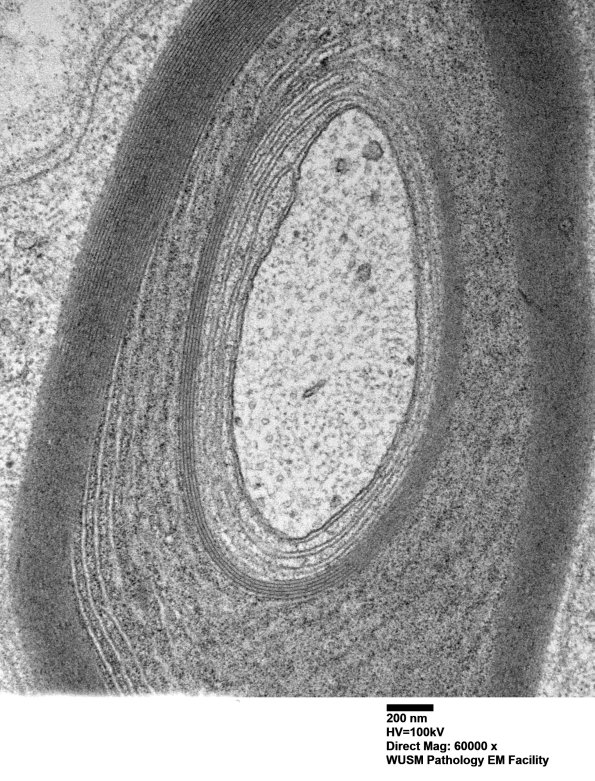 1B2C (Case 1) Sural_039 - Copy