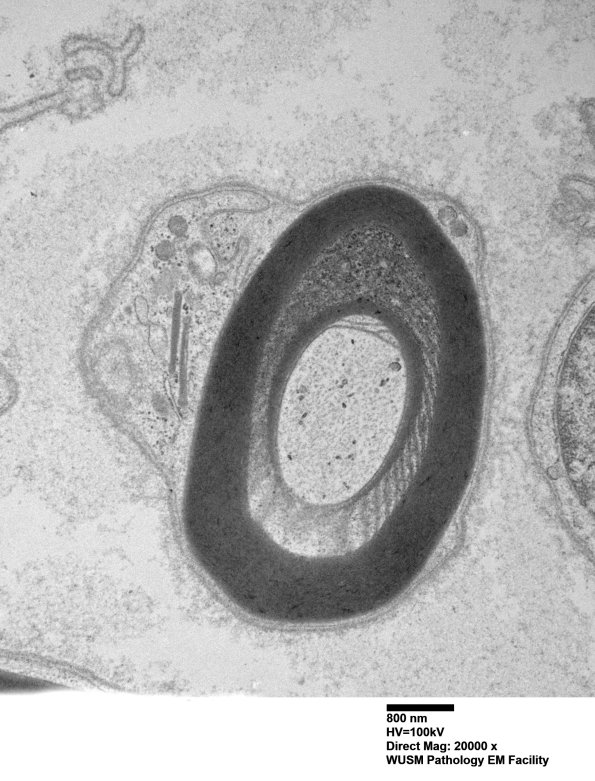 1B5 (Case 1) Sural_065 - Copy