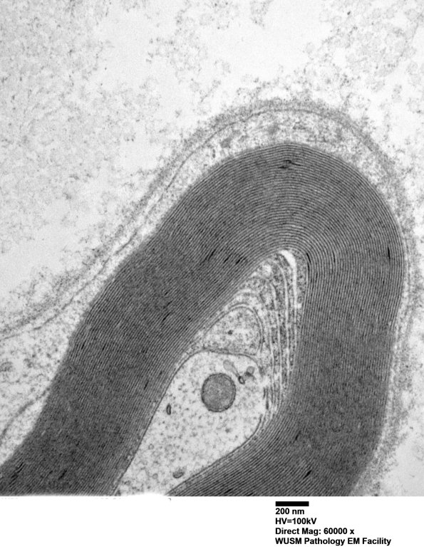 1C1 (Case 1) Sural_008 - Copy