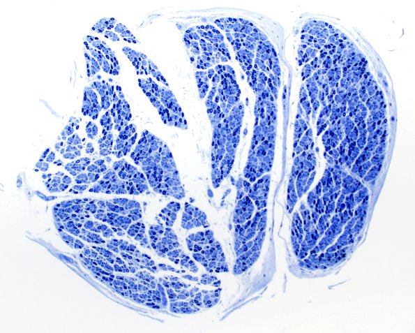 2B1 POEMS (Case 2) Plastic 10X 2