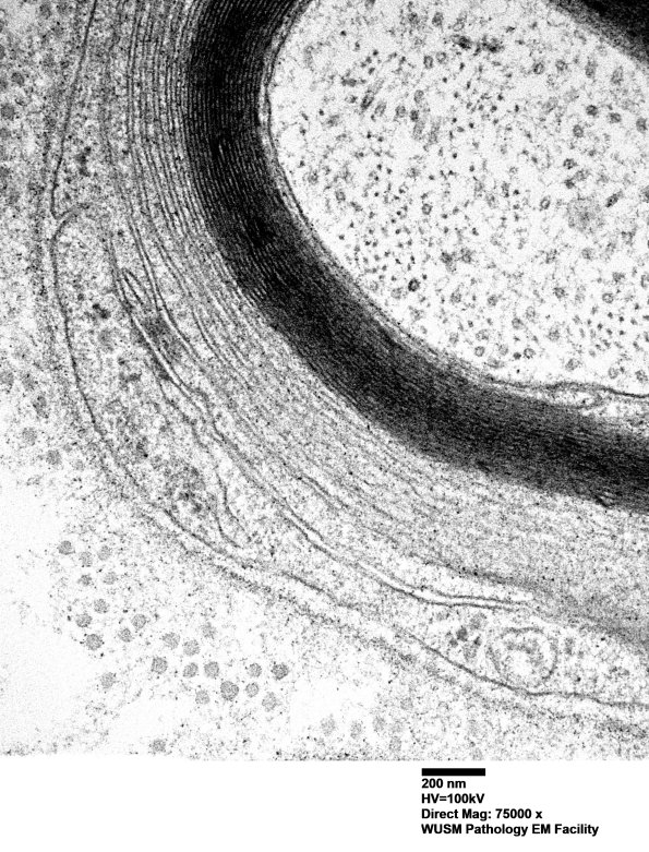 2C1C POEMS (Case 2) EM 026 - Copy